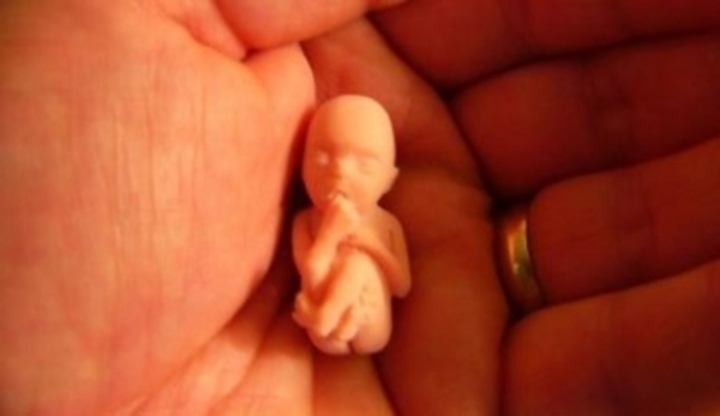 Embryo dítěte na dlani 