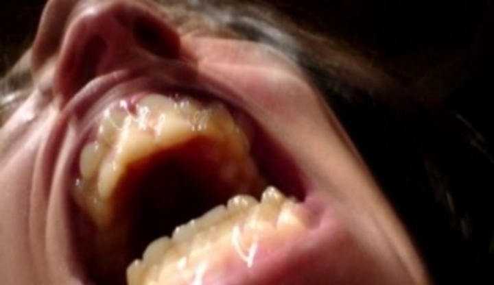 Zuby v otevřených ústech 