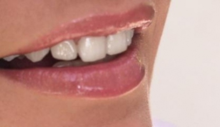 Úsměv s bílými zuby 