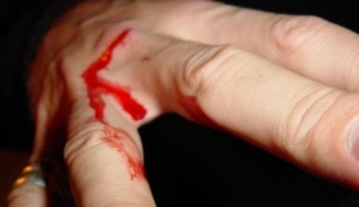Krev na prstech