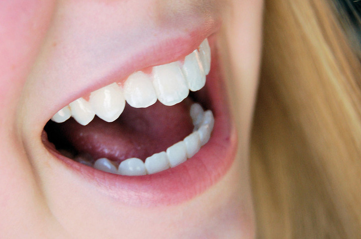 Otevřená pusa s bílými zuby 