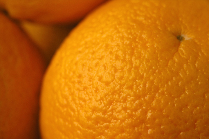 celulitida neboli pomerančová kůže